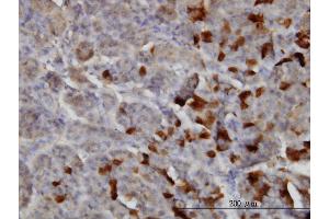 Immunoperoxidase of monoclonal antibody to LAMA2 on formalin-fixed paraffin-embedded human pancreas. (Laminin 抗体  (AA 3013-3122))