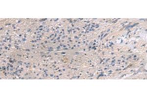 Immunohistochemistry of paraffin-embedded Human brain tissue using PAIP1 Polyclonal Antibody at dilution of 1:80(x200) (PAIP1 抗体)