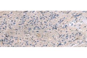Immunohistochemistry of paraffin-embedded Human brain tissue using PAIP1 Polyclonal Antibody at dilution of 1:80(x200) (PAIP1 抗体)