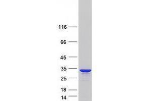 Hydroxysteroid (17-Beta) Dehydrogenase 14 (HSD17B14) protein (Myc-DYKDDDDK Tag)