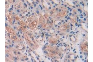 Immunohistochemistry (IHC) image for anti-Tripeptidyl Peptidase I (TPP1) (AA 198-562) antibody (ABIN7440935)