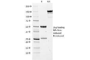 SDS-PAGE Analysis Purified CEA Mouse Monoclonal Antibody (COL-1). (CEACAM5 抗体)