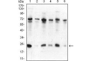 Western Blotting (WB) image for anti-Chromobox Homolog 5 (CBX5) (AA 1-191) antibody (ABIN5542712)