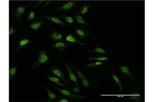 Immunofluorescence of monoclonal antibody to MAP2K2 on HeLa cell. (MEK2 抗体  (AA 1-360))