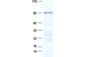Western Blotting (WB) image for CDK5 Regulatory Subunit Associated Protein 1 (CDK5RAP1) protein (His tag) (ABIN2713866)