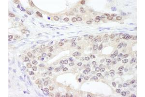 Immunohistochemistry (IHC) image for anti-Splicing Factor 3a, Subunit 1 (SF3A1) (AA 500-550) antibody (ABIN7453781)