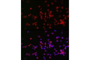 Immunofluorescence analysis of Neuro-2a cells using NOGO Receptor 1 (RTN4R) Rabbit pAb (ABIN6129725, ABIN6147296, ABIN6147297 and ABIN6221547) at dilution of 1:25 (40x lens). (RTN4R 抗体  (AA 244-473))