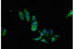 Immunofluorescent analysis of Hela cells using ABIN7169242 at dilution of 1:100 and Alexa Fluor 488-congugated AffiniPure Goat Anti-Rabbit IgG(H+L) (PPP2R2A 抗体  (Regulatory Subunit B))