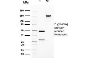 SDS-PAGE Analysis Purified Uroplakin 1B Mouse Monoclonal Antibody (UPK1B/3102). (Uroplakin 1B 抗体  (AA 109-229))