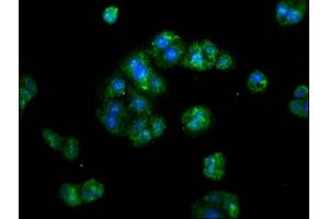 Immunofluorescence staining of HepG2 cells with ABIN7142343 at 1:133, counter-stained with DAPI. (ERI1 抗体  (AA 2-66))