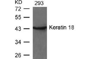 Image no. 2 for anti-Keratin 18 (KRT18) (AA 31-35) antibody (ABIN197580) (Cytokeratin 18 抗体  (AA 31-35))