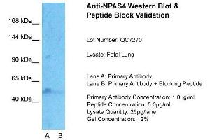 Host:  Rabbit  Target Name:  NPAS4  Sample Type:  Fetal Lung  Lane A:  Primary Antibody  Lane B:  Primary Antibody + Blocking Peptide  Primary Antibody Concentration:  1ug/ml  Peptide Concentration:  5ug/ml  Lysate Quantity:  25ug/lane/Lane  Gel Concentration:  0. (NPAS4 抗体  (Middle Region))