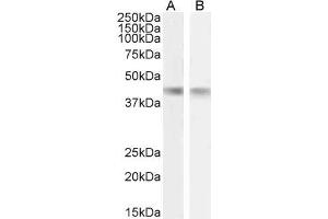 ABIN1590065 (1µg/ml) staining of Mouse (A) and Rat (B) Heart lysate (35µg protein in RIPA buffer). (CKM 抗体  (AA 258-270))