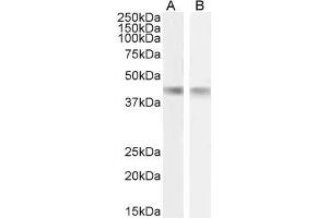ABIN1590065 (1µg/ml) staining of Mouse (A) and Rat (B) Heart lysate (35µg protein in RIPA buffer).