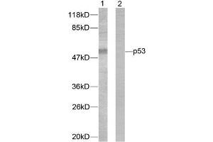 Western blot analysis of extracts from 293 cells treated with (p53 抗体)