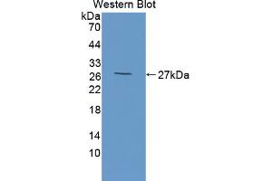 Western blot analysis of the recombinant protein. (HAP1 抗体  (AA 132-328))