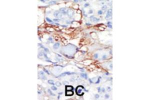 Immunohistochemistry (IHC) image for anti-Platelet-Derived Growth Factor Receptor-Like (PDGFRL) antibody (ABIN3003406) (PDGFRL 抗体)