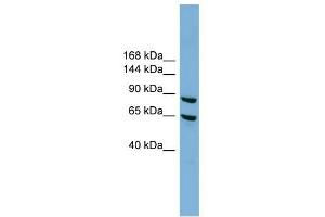 EXOC6 antibody used at 1 ug/ml to detect target protein.