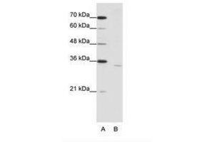 CPEB2 抗体  (AA 473-522)