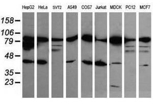 Image no. 1 for anti-Catenin (Cadherin-Associated Protein), beta 1, 88kDa (CTNNB1) antibody (ABIN1496898) (CTNNB1 抗体)