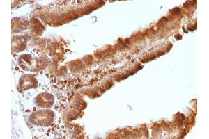 Immunohistochemistry (IHC) image for anti-Ornithine Decarboxylase 1 (ODC1) antibody (ABIN6940237)
