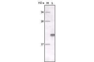Western blot analysis using MER mouse mAb against fragment MER recombinant protein. (MERTK 抗体)