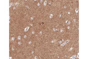 ABIN6267646 at 1/200 staining human brain tissue sections by IHC-P. (Cortactin 抗体  (pTyr466))