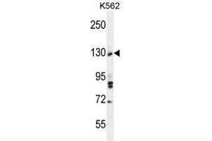 TTBK2 Antibody (N-term) western blot analysis in K562 cell line lysates (35 µg/lane). (TTBK2 抗体  (N-Term))