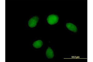 Immunofluorescence of purified MaxPab antibody to HUS1 on HeLa cell. (HUS1 抗体  (AA 1-280))
