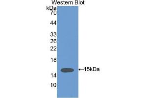 Western Blotting (WB) image for anti-Vinculin (VCL) (AA 1020-1134) antibody (ABIN1175095) (Vinculin 抗体  (AA 1020-1134))