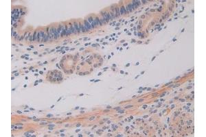 Detection of IL11Ra in Mouse Uterus Tissue using Polyclonal Antibody to Interleukin 11 Receptor Alpha (IL11Ra)
