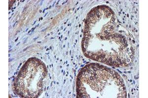 Image no. 2 for anti-Histidyl-tRNA Synthetase 2, Mitochondrial (Putative) (HARS2) antibody (ABIN1498584) (HARS2 抗体)