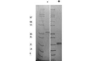SDS-PAGE of Rat Vascular Endothelial Growth Factor-165 Recombinant Protein SDS-PAGE of Rat Vascular Endothelial Growth Factor-165 Recombinant Protein. (VEGF 165 蛋白)