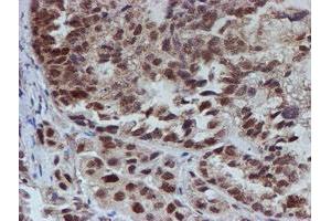 Image no. 1 for anti-ATR Interacting Protein (ATRIP) (AA 42-309) antibody (ABIN1491507) (ATRIP 抗体  (AA 42-309))