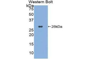 Western Blotting (WB) image for anti-CD302 (CD302) (AA 23-232) antibody (ABIN3206160) (DCL1 抗体  (AA 23-232))