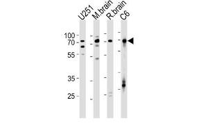 Western Blotting (WB) image for anti-Far Upstream Element (FUSE) Binding Protein 1 (FUBP1) antibody (ABIN2997751) (FUBP1 抗体)