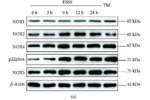 Earle's balanced salt solution (EBSS) increases NADPH oxidative activity and ROS generation in ARPE-19 cells in a time-dependent manner. (NOX5 抗体  (AA 661-765))