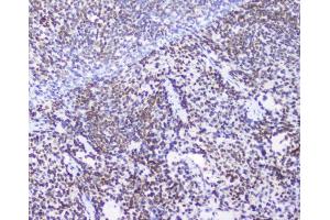 IHC analysis of AHR using anti-AHR antibody (ABIN6719265).