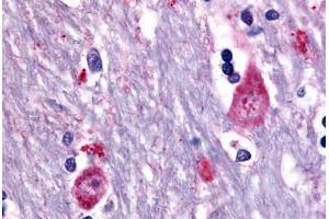 Human Brain, Caudate (formalin-fixed, paraffin-embedded) stained with CHRM3 antibody ABIN213499 at 10 ug/ml followed by biotinylated goat anti-rabbit IgG secondary antibody ABIN481713, alkaline phosphatase-streptavidin and chromogen. (CHRM3 抗体  (Cytoplasmic Domain))