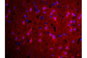 Formalin-fixed and paraffin embedded rat brain labeled with Rabbit Anti-TGM2 Polyclonal Antibody, Unconjugated used at 1:200 dilution for 40 minutes at 37°C (Transglutaminase 2 抗体  (AA 551-650))