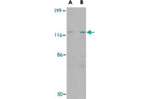 Western blot analysis of SLITRK3 in SK-N-SH cell lysate with SLITRK3 polyclonal antibody  at (A) 0. (SLITRK3 抗体  (C-Term))