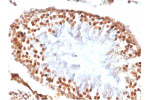 Formalin-fixed, paraffin-embedded Rat Testis stained with Wilm's Tumor Rabbit Recombinant Monoclonal Antibody (WT1/1434R). (Recombinant WT1 抗体)