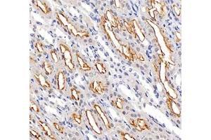 Immunohistochemistry of paraffin embedded mouse kidney using ADCY4 (ABIN7072959) at dilution of 1: 700 (400x lens) (ADCY4 抗体)