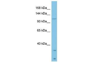 Laminin Beta 3 antibody used at 1 ug/ml to detect target protein.