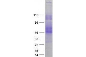 Validation with Western Blot