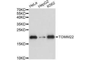 Western blot analysis of extracts of various cell lines, using TOMM22 antibody. (TOMM22 抗体)