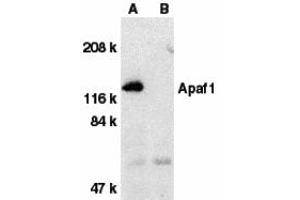 Western Blotting (WB) image for anti-Apoptotic Peptidase Activating Factor 1 (APAF1) (C-Term) antibody (ABIN1030242) (APAF1 抗体  (C-Term))