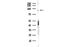 anti-SH3 Domain Containing Ring Finger 3 (SH3RF3) (C-Term) antibody