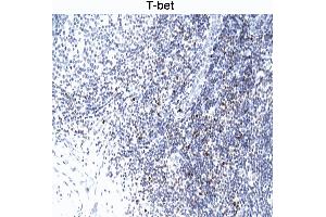 T-bet staining of human tonsil. (T-Bet 抗体)