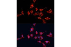Immunofluorescence analysis of C6 cells using  antibody (ABIN7265433) at dilution of 1:100. (ADAM11 抗体  (AA 290-430))